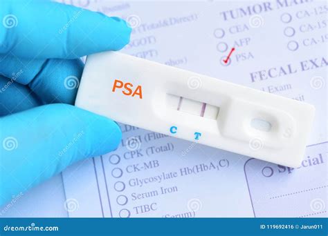 psa test results positive